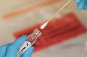 La UE no encuentra consenso para los test r&aacute;pidos de coronavirus